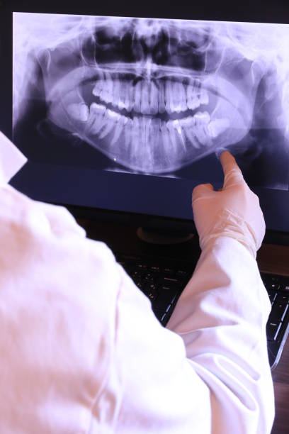 Best Emergency Tooth Extraction in Belle Plaine, KS